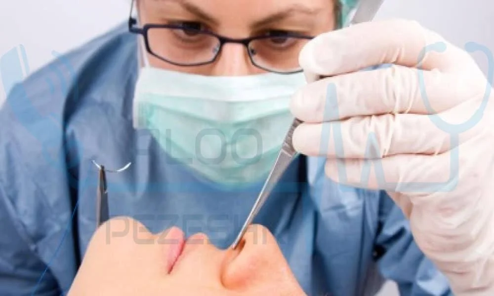 روکش دندان بعد از عمل بینی