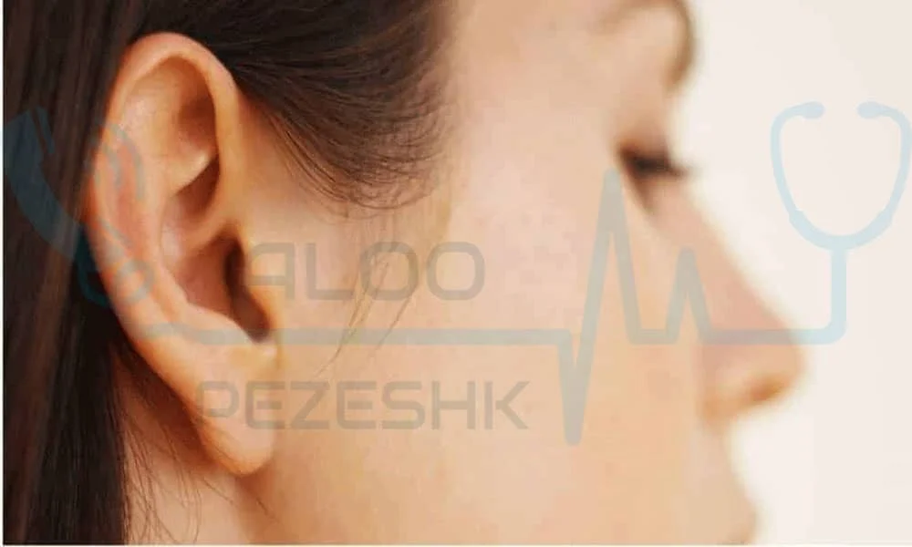 چرا افراد به جراحی گوش روی می‌آورند؟