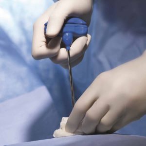 آیا آزمایش مغز استخوان درد دارد؟ | مراحل، نتایج، مراقبتها و عوارض