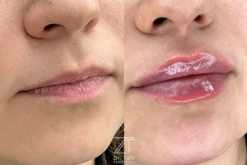 کلینیک دکتر تفت | بهترین خدمات پوست، مو و زیبایی در تهران