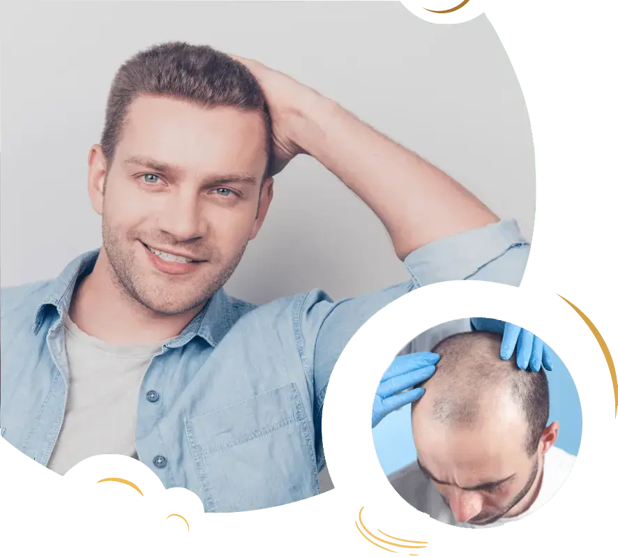 مرکز کاشت مو رنسانس