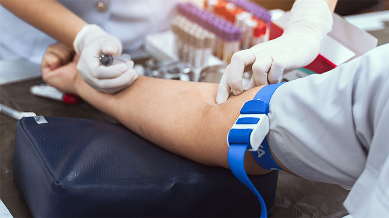 آزمایشهای پیش از ازدواج چه آزمایشهایی هستند؟