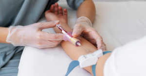 آیا آزمایش cbc باید ناشتا بود؟