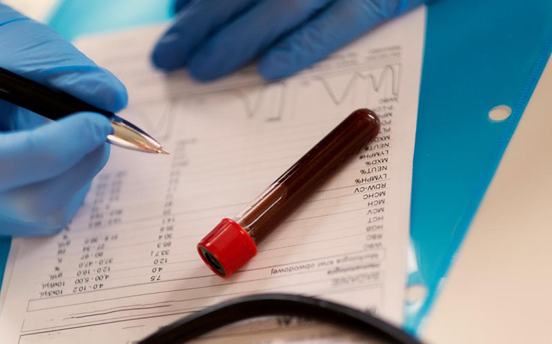 آزمایش cbc بدون نیاز به ناشتایی