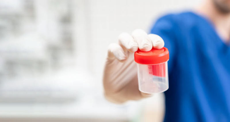 قرار دادن نمونه در ظرف استریل