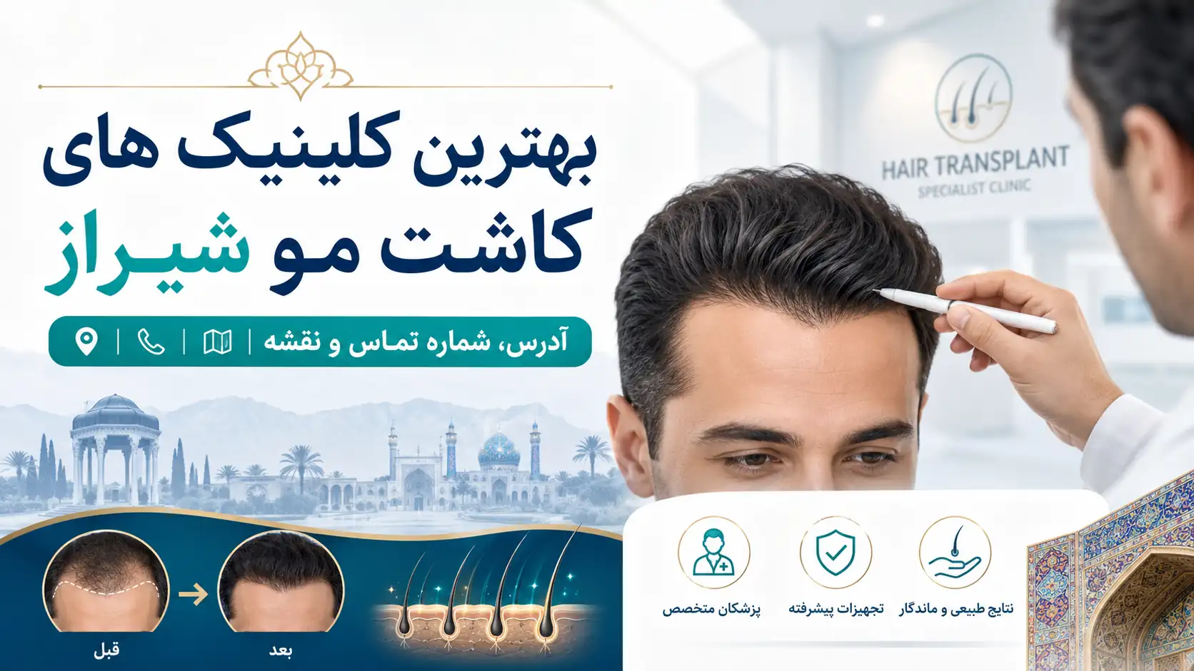 بهترین کلینیک های کاشت مو شیراز
