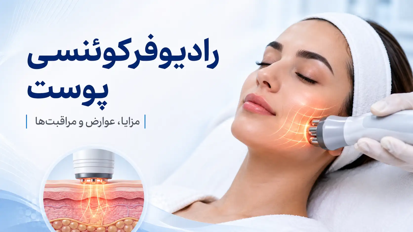 رادیوفرکوئنسی