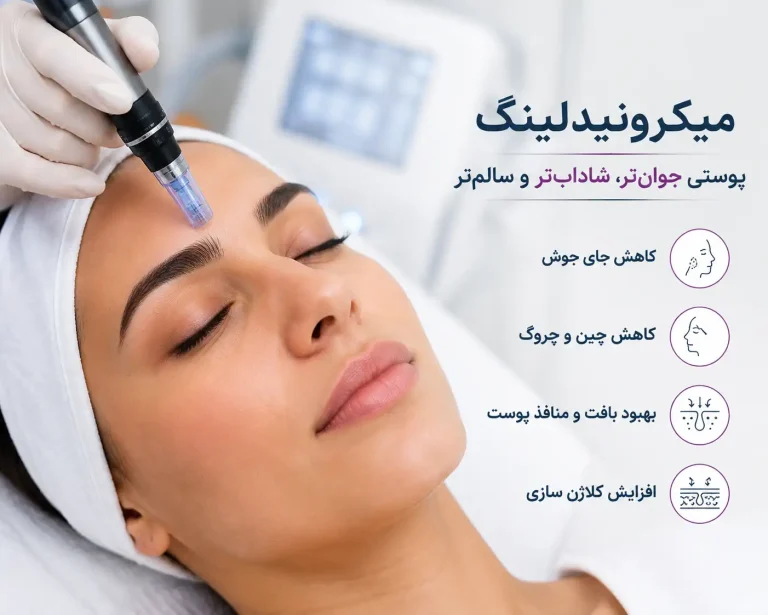 میکرونیدلینگ روشی برای تحریک کلاژن‌سازی و بهبود جای جوش، چروک و لک پوست است. با فواید، عوارض و مراقبت‌های آن آشنا شوید.