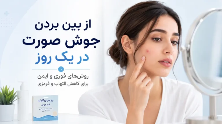 از بین بردن جوش صورت در یک روز