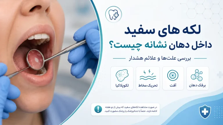 لکه‌های سفید داخل دهان
