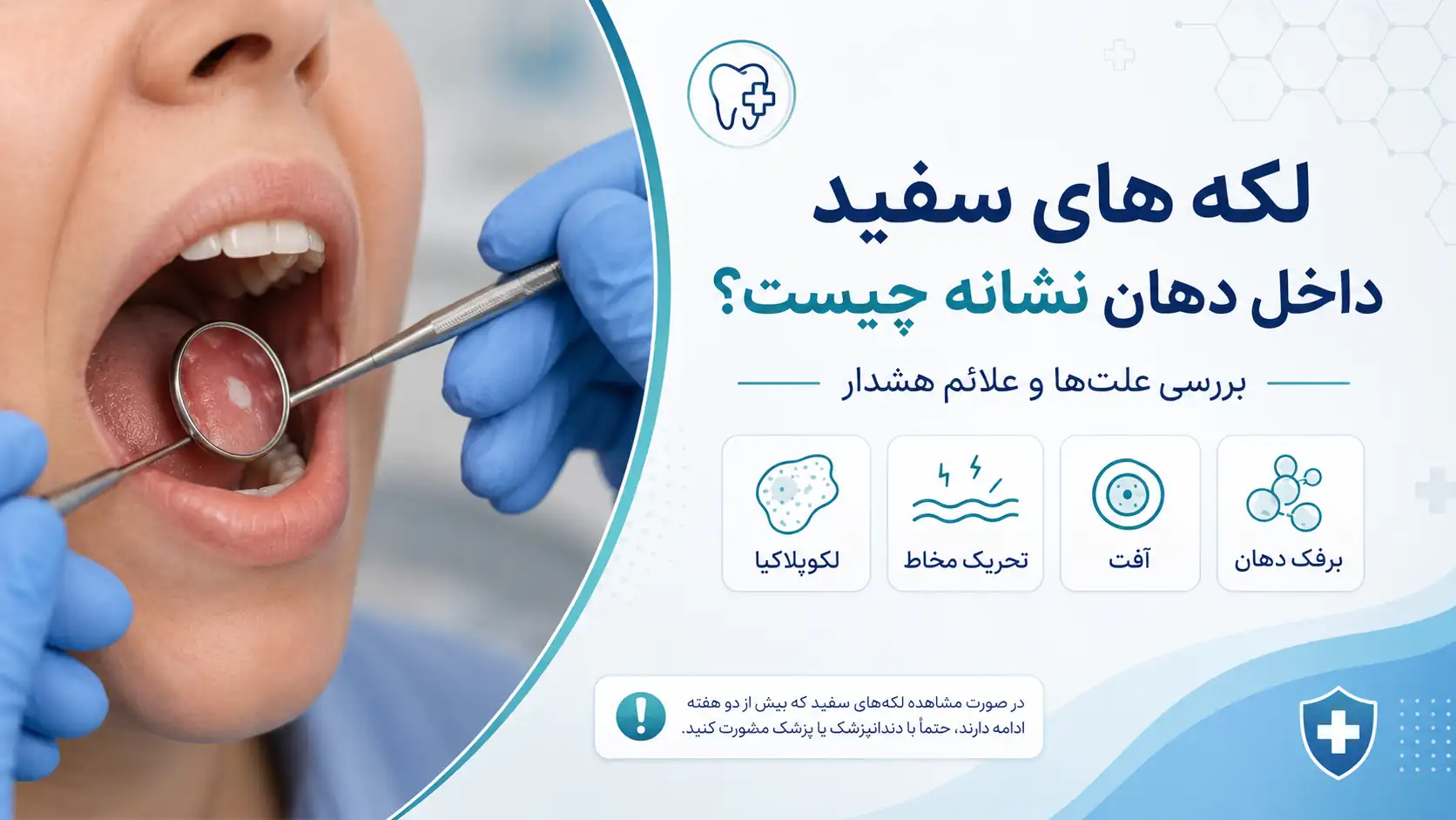 لکه‌های سفید داخل دهان