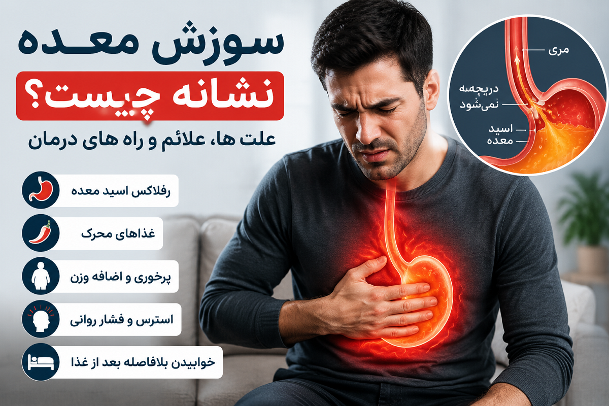 سوزش معده