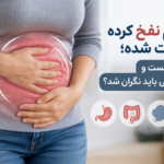 علت نفخ و سفت شدن شکم