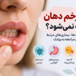 علت خوب نشدن زخم دهان