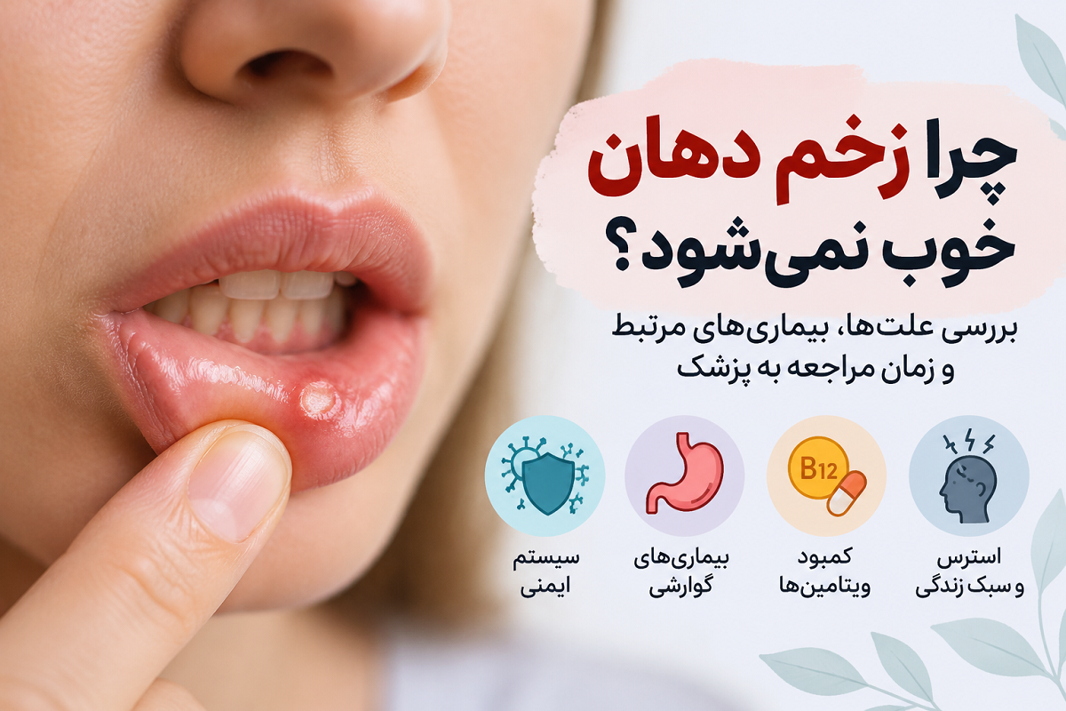 چرا زخم دهان خوب نمی‌شود؟ بررسی علت‌ها، بیماری‌های مرتبط و زمان مراجعه به پزشک